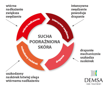 swędzenie - atopowe zapalenie skóry