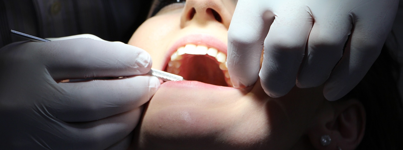 czy fluor jest bezpieczny?