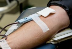 PDW (morfologia krwi) - badanie, normy, obniżone i podwyższone wskaźniki