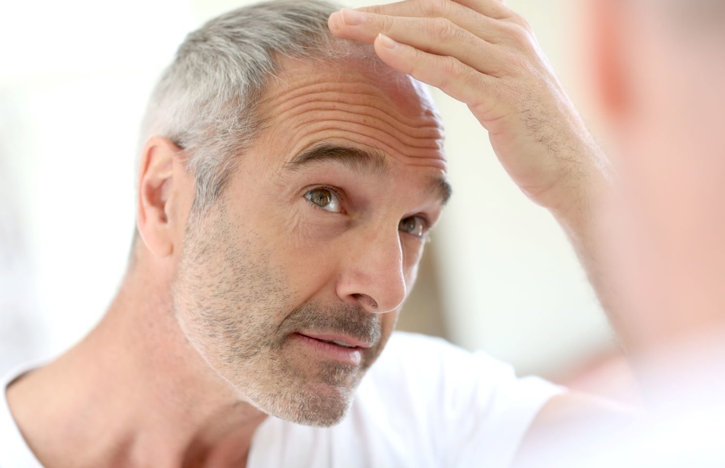 wypadanie włosów po COVID-19