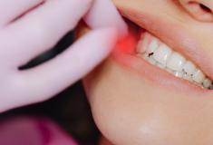 Afty – objawy, przyczyny i sposoby leczenia