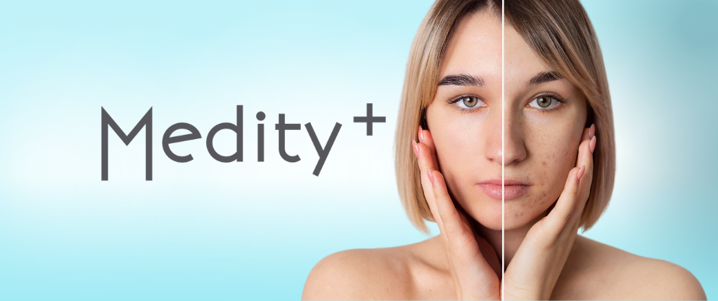 Medity+ przebarwienia - odzyskaj jednolity koloryt skóry